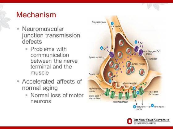 2015OPNConferenceDAdamQuickPostPolioSyndrome/Slide12.JPG