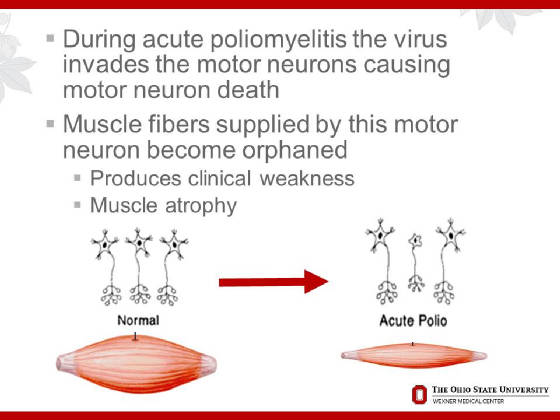 2015OPNConferenceDAdamQuickPostPolioSyndrome/Slide5.JPG